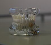 material proteza dentara